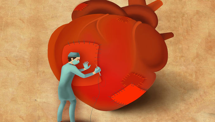 心衰是怎么引起的(心衰具体分为哪几种类型心衰可以治好吗)