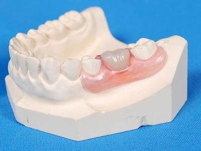 为什么牙龈萎缩(常见的牙龈萎缩治疗方法有哪几种)